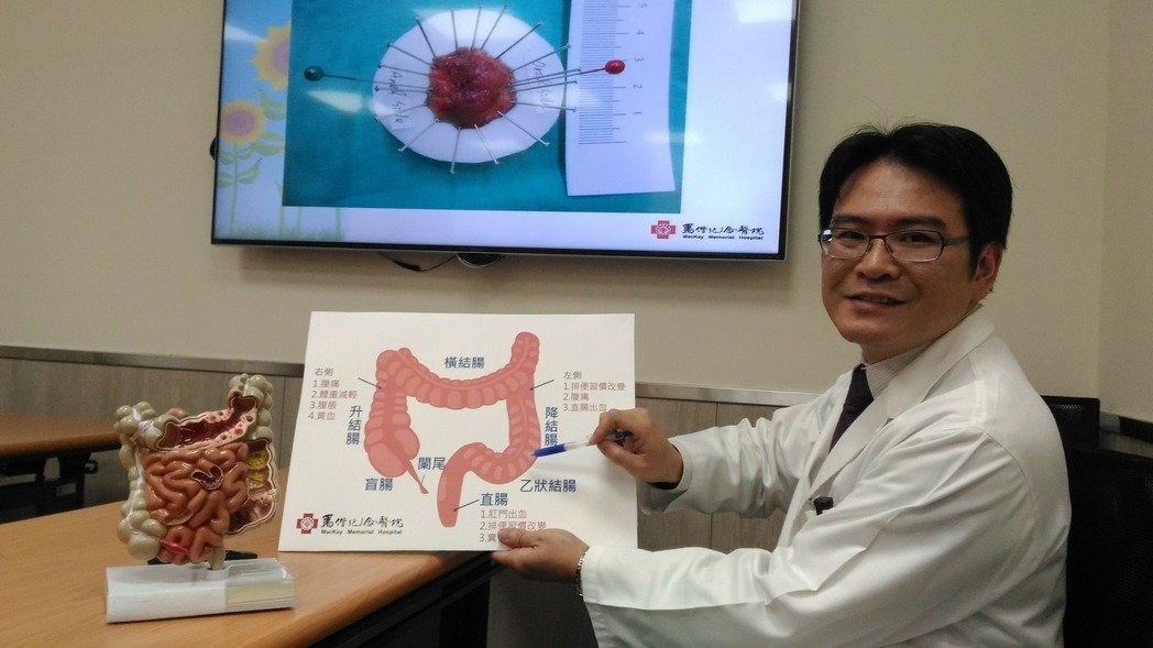 大腸瘜肉癌病變機率高 早期大腸癌治療有利器說明圖片