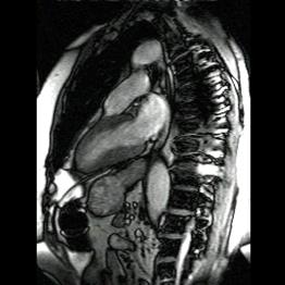 長軸影像（long axis view） 